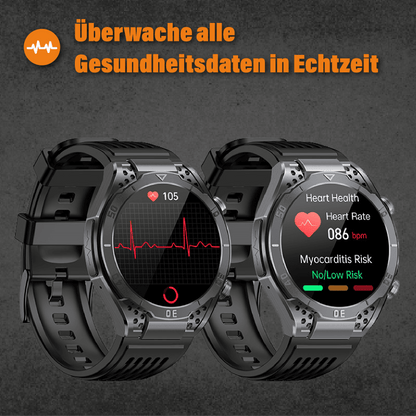 Apollo - EKG Smartwatch