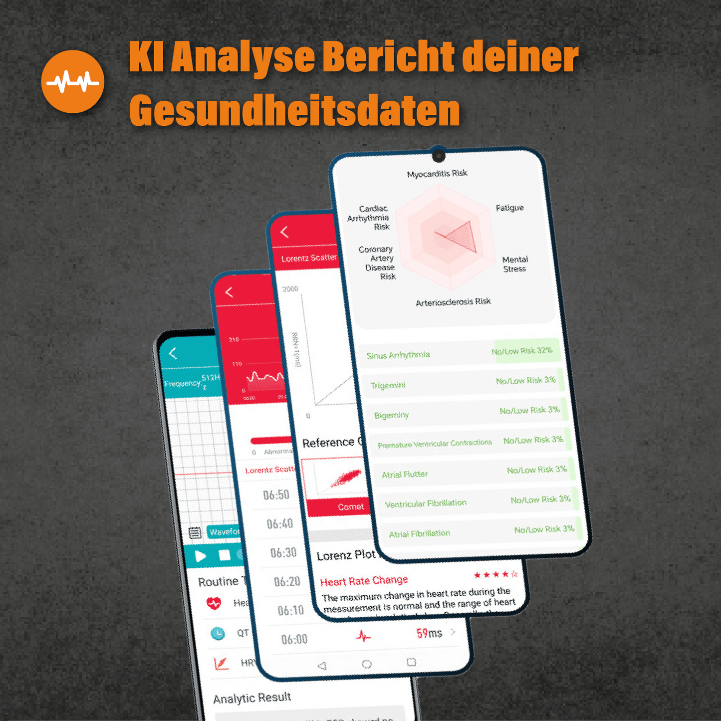 Apollo - EKG Smartwatch