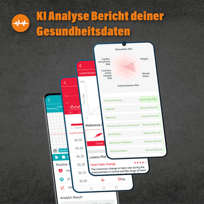 Apollo - EKG Smartwatch