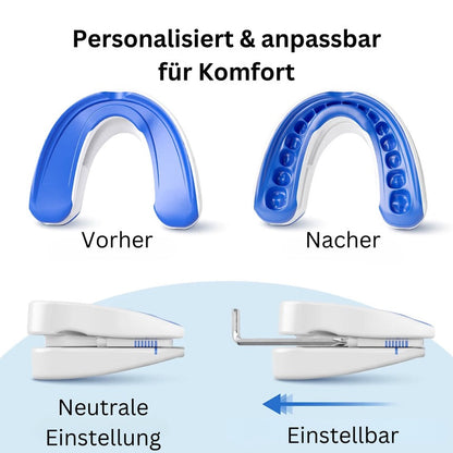 Anti-Schnarch-Schiene (Zahnschutz)